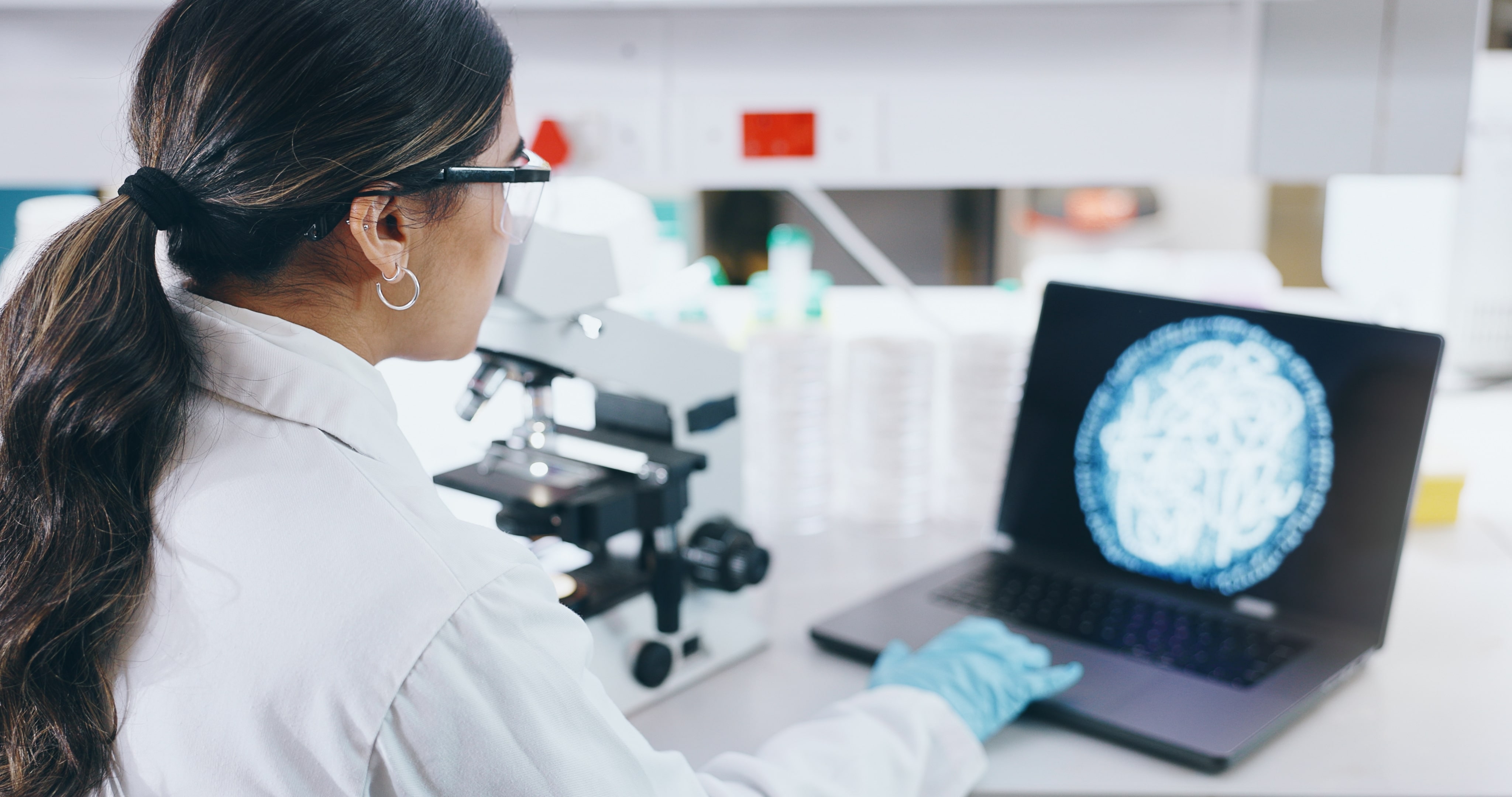 Résistance aux antimicrobiens la France renforce son engagement international et se donne des priorités d’action-min