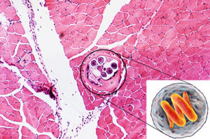 trichinellose_422626885